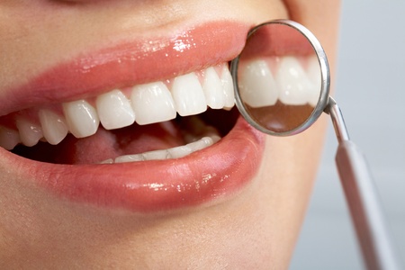 Close-up of patientï¿½s healthy smile with mirror near byの写真素材