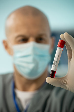 Gloved hand of researcher holding sample of covid positive human bloodの写真素材