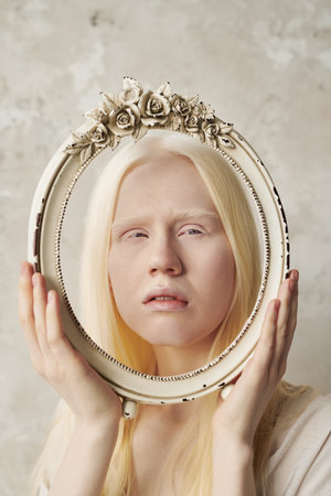 Face of young serene albino woman in oval antique frame decorated with roses during stylish photo session in studio with marble wallsの写真素材