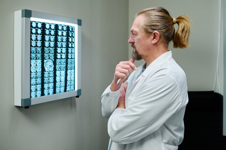 Side view of pensive mature male radiologist looking at ct scan of patient brain hanging on wall while standing in front of examination resultsの写真素材
