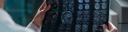 Medical professional in white coat examining detailed brain scans on transparent lightboard in clinical setting, focusing on neurological abnormalities and health informationの写真素材