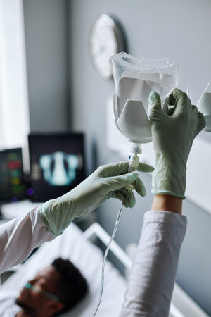 Medium close-up of unrecognizable nurse wearing protective latex gloves changing IV bag for patient in hospital wardの写真素材