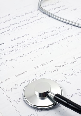 Stethoscope on real EKG の写真素材