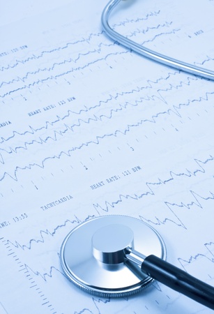 Stethoscope and EKG in blue tone
の写真素材