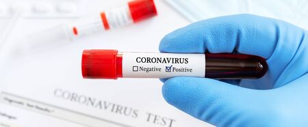 Panorama of Coronavirus testing. Doctor hand in medical glove holding test tube with Coronavirus positive blood over laboratory desk.の写真素材