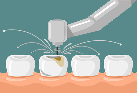 Vector dental flat illustrationのイラスト素材