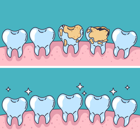 Bad good tooth in mouth dental treatment clean concept. Vector flat graphic design illustrationのイラスト素材