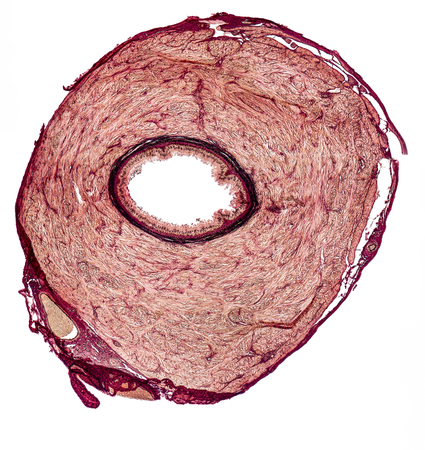 microscopic cross section showing the vas deferens of a rat