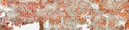 full frame abstract microscopic detail of a human fatty liver