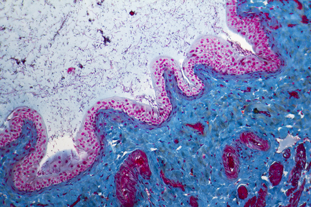 micrograph showing a urinary bladder detail from a rat