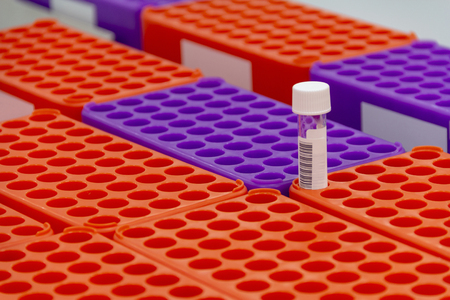 Closeup shot of medical sample racks