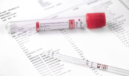 glass tube with test tube on the general blood analysis results closeup backgroundの写真素材