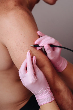 A female specialist performs electrolysis on a man, smooth hair-free skin.の写真素材