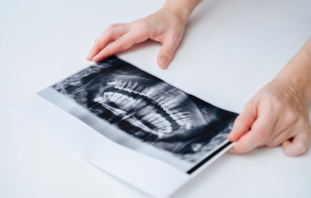 Dentist holding a dental x-ray against a white background with space for text, showing professional oral care.の写真素材