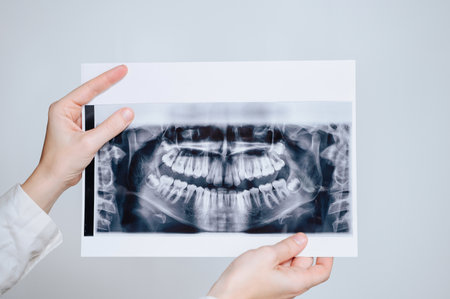 Woman hands holding two dental panoramic X-ray images in front of herの写真素材