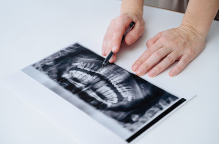 Hands pointing with a pen at dental panoramic X-ray on a white tableの写真素材