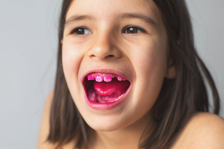 close-up portrait of 7 year old girl with her mouth open and teeth with pink plaque indicator solution applied to teeth, concept of dental hygiene and health.の写真素材