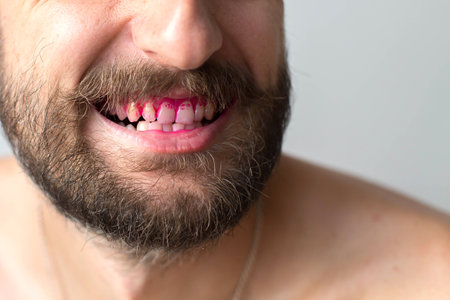 Close up of adult men's teeth with pink plaque indicator solution applied to teeth, concept of dental hygiene and health.の写真素材