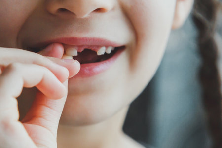 The girl shows her mouth without one milk tooth that has fallen out, close-up, the girl s face is...