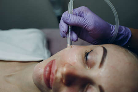 Woman Getting Vacuum Cleaning Face Treatment At Beauty Clinicの写真素材