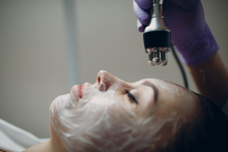 Young woman receiving electric RF lifting facial massage at beauty spa with electroporation equipmentの写真素材