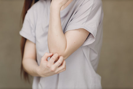 Allergy dermatology scabies itches hand skin problem womanの写真素材