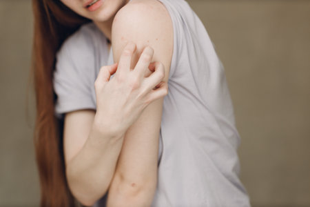 Allergy dermatology scabies itches hand skin problem womanの写真素材