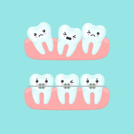 Braces alignment stomatology concept. Cute cartoon vector teeth isolated illustrationのイラスト素材