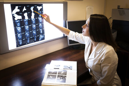 Doctor explores images of computer tomographyの写真素材