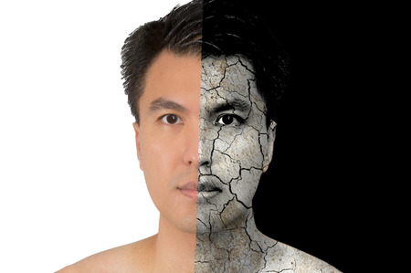 asian man face on good healthy skin and damaged,dry skin. isolatedの写真素材