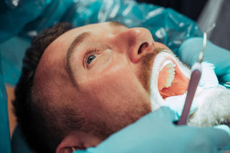 Caucasian male lying down with mouth wide open while male nurse operates on teethの写真素材