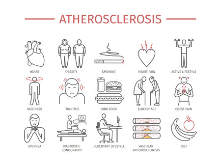 Atherosclerosis. Symptoms, Treatment. Line icons set. Vector signsのイラスト素材