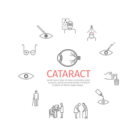 Cataract. Symptoms, Treatment. Line icons set. Vector signsの写真素材