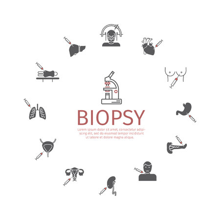 Biopsy: Types of biopsy procedures used to diagnose cancerのイラスト素材