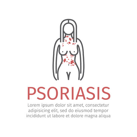 Psoriasis. Vector iconのイラスト素材