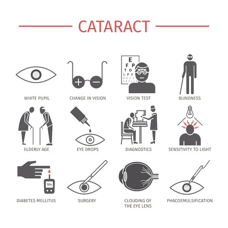 Cataract. Symptoms, Treatment. Icons set. Vector signsのイラスト素材