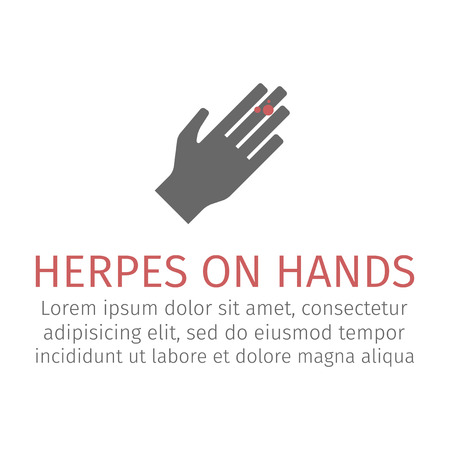 Herpes on hands. Vector iconのイラスト素材