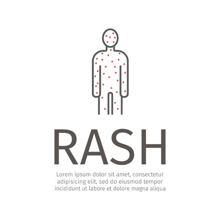 Rash Icon. Vector sign for web graphic.のイラスト素材