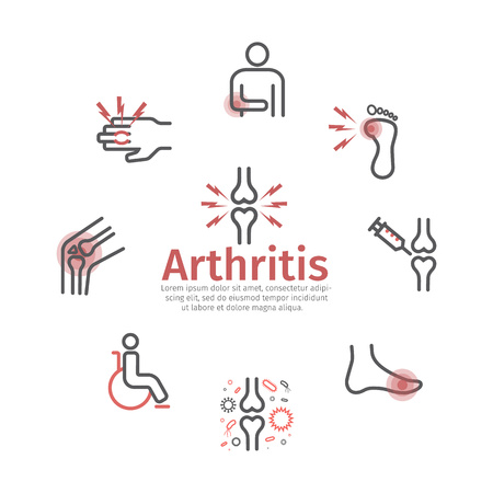 Arthritis. Symptoms, Treatment. Line icons Vector signs for web graphicsのイラスト素材
