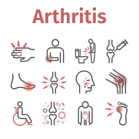 Arthritis. Symptoms, Treatment. Line icons set. Vector signs for web graphics.のイラスト素材