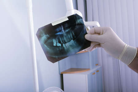 Dental background: work in clinic (operation, tooth replacement)
の写真素材