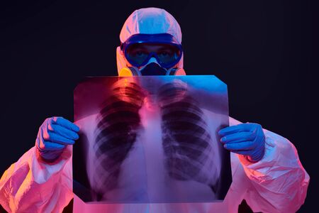 COVID-19 or 2019-nCoV. Portrait of a doctor in a protective PPE suit showing an x-ray picture of the lungs of a patient with coronavirus pneumonia.の写真素材