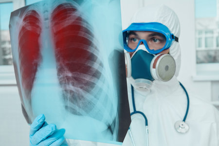 COVID-19 or 2019-nCoV. A doctor pneumologist examines an x-ray picture of the lungs of a patient...