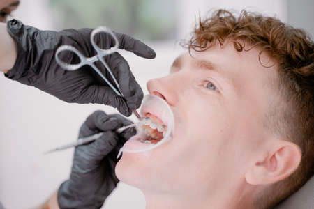 the orthodontist fixes the arch with ligatures to the braces, happy patient with curly hairの写真素材