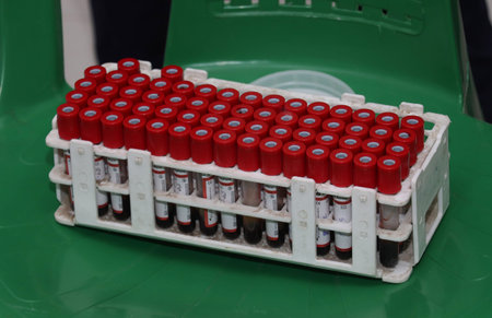 donated blood sample stock photo in blood donation camp