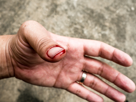 Left thumb The blood flow caused by the estimate should not be cautious in repairing the plumbing.の写真素材