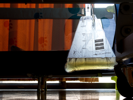 Urine collection bag attached to patient bed with orange light from the window in hospital.の写真素材
