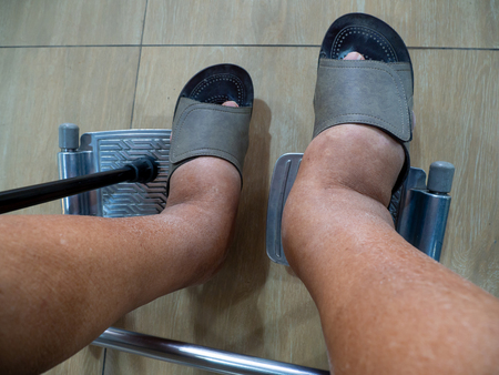 Men with diabetes and kidney disease With swelling feet. Can not wear shoes. he was in a wheelchair in the hospital for a battle to see a doctor for treatment.の写真素材