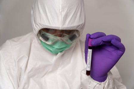 Doctors in the protective suits and masks are holding a positive blood test result for new rapidly...