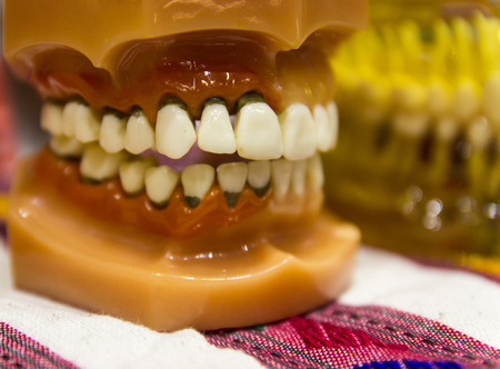 the teeth prosthesis model for oral educationの写真素材